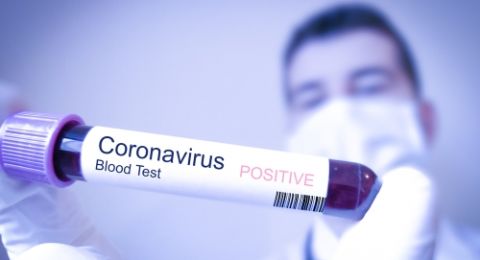 Corona Virus - Graha Nusantraa